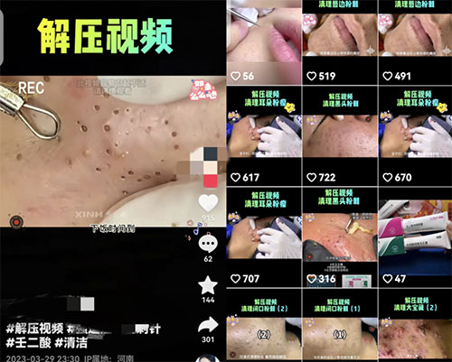 解压小视频，涨粉上千就能轻松销量破万-云创项目库